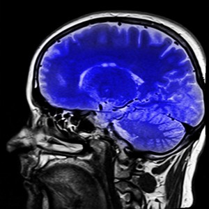 Privacy after brain injury. Brain image with black and white skull and brain coloured blue
